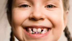 Ortodonzia per bambini
